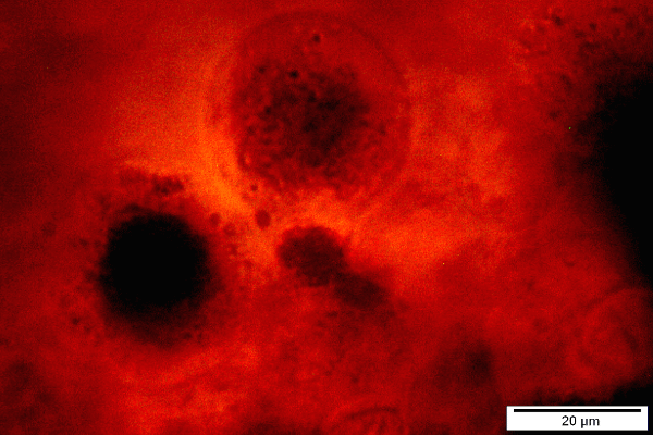 Sporulation von Myxosporidien im Extremitätengewebe einer Ziergarnele. Myxosporidia wie Microsporiedia gehören ebenso zu den Killern der Krebstiere wie die verschiedenen Virus Syndrome EMS, WSDS und viele mehr.
